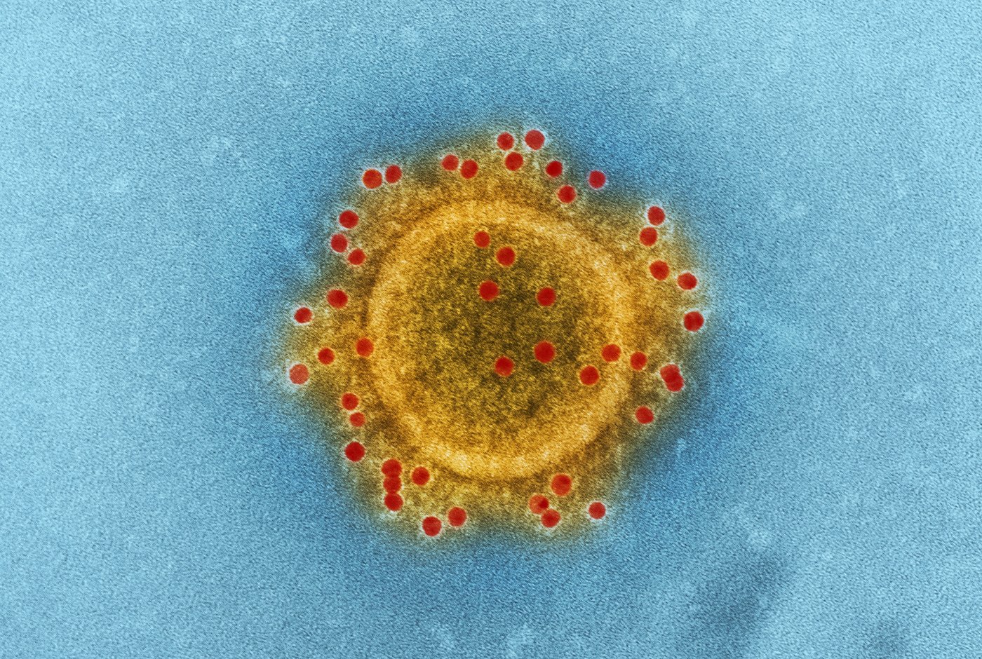 a yellow circle with red spots