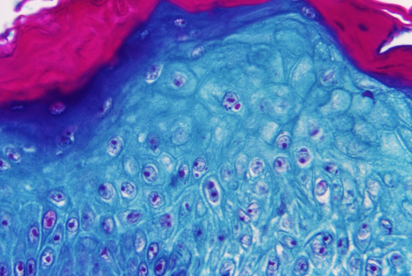 virus on monkey skin