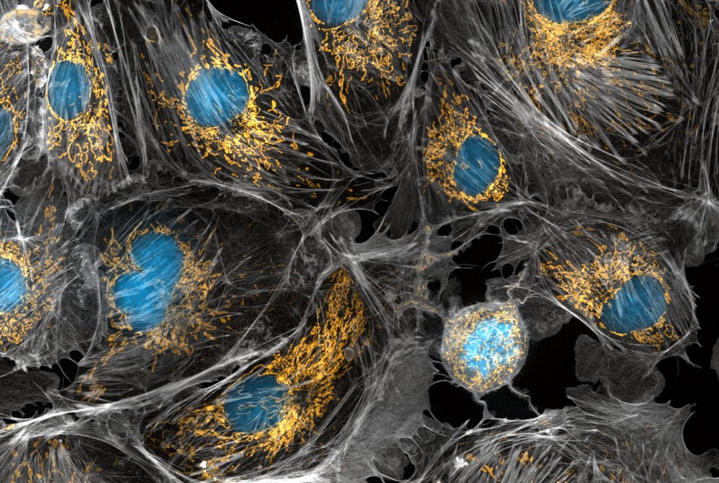 mitochondria