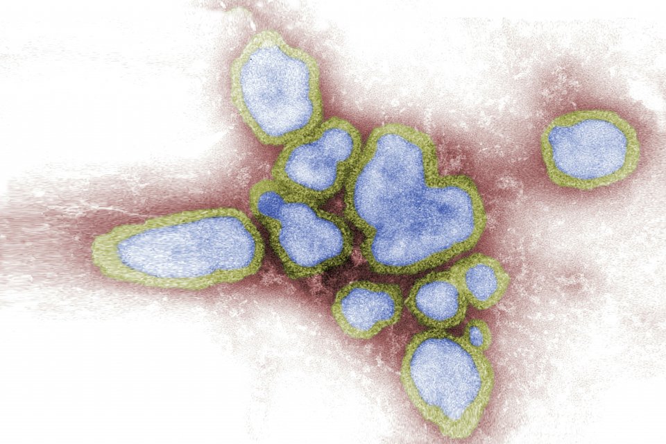 a group of influenza cells