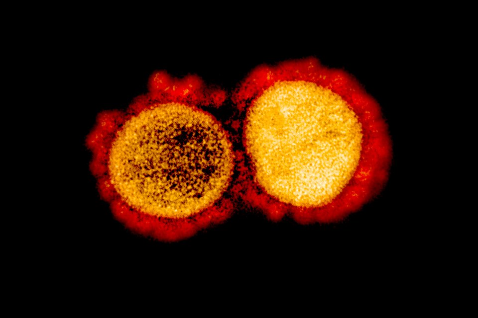 SARS-CoV-2 virus particles.